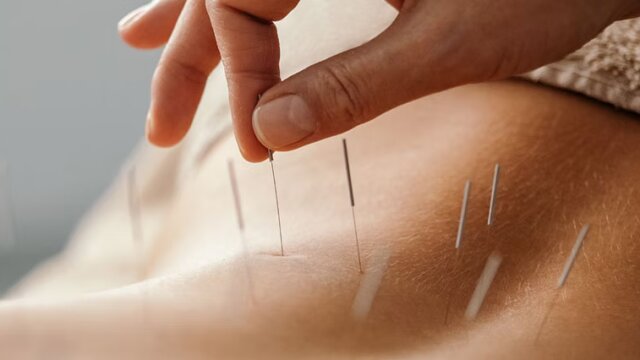 Orthopedic Alternatives